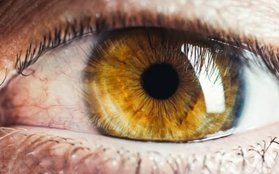 RETINOPATÍA DIABÉTICA