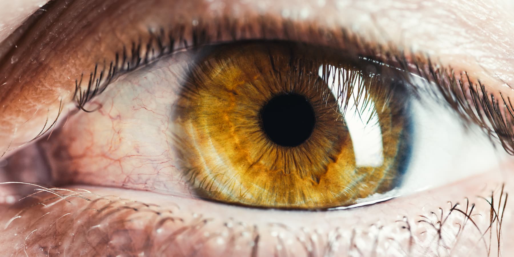 retinopatia-diabetica