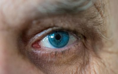 ¿Qué es el glaucoma?